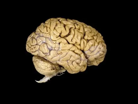 What Can You Do Without a Brain? thumbnail