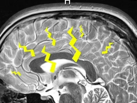 Why Do We Dream? thumbnail