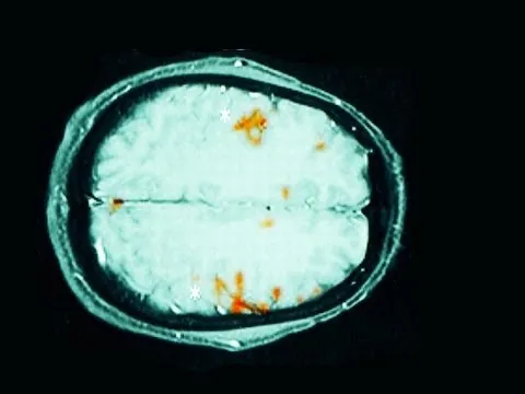 What's Left? thumbnail