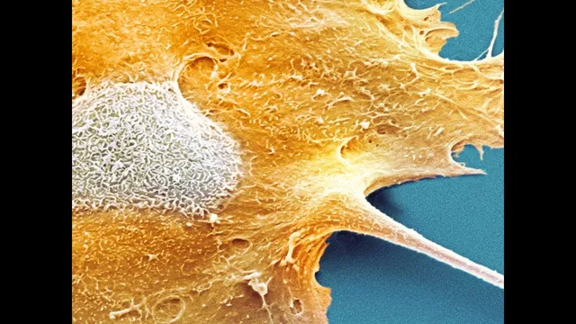 Why Don't We All Have Cancer? thumbnail