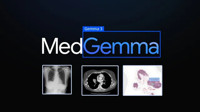 MedGemma - An Open Doctor Model? thumbnail